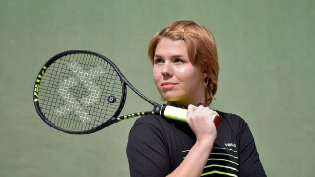Croatian Tennis Player Auction Arm as NFT | Dailycoin.com Top 10 Weirdest Things That Have Been Minted and Sold as NFTs | Dailycoin.com