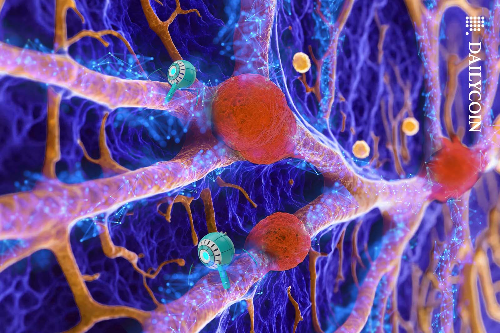 Digital blood vessels clogged up in three areas.